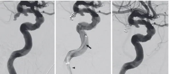 Fig. 2  Intraoperative angiography of a representative case.