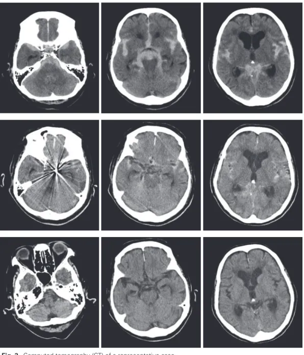 Fig. 3  Computed tomography (CT) of a representative case.