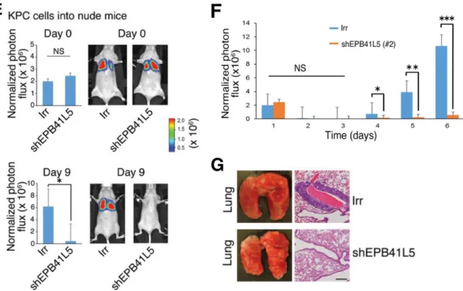 図 5 RNA 干渉が ARF6 活性化、浸潤、転移に及ぼす影響 