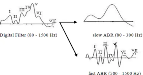 Fig. 7. ABR の緩徐波 (slow ABR) と速波成分 (fast ABR) の分離 [15].