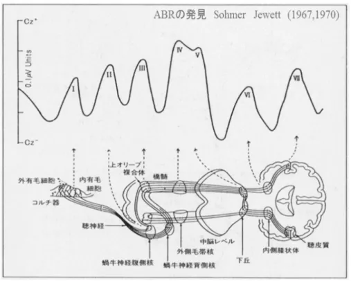 Fig. 3. ABR 各ピーク波と発生源との対応 (Stockard, 1977 [29] を日本語表記).