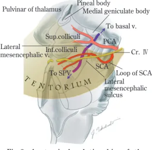 Fig.   2  Anatomical relationship of the  tentorium, trochlear nerve, and  major vessels around the brain stem