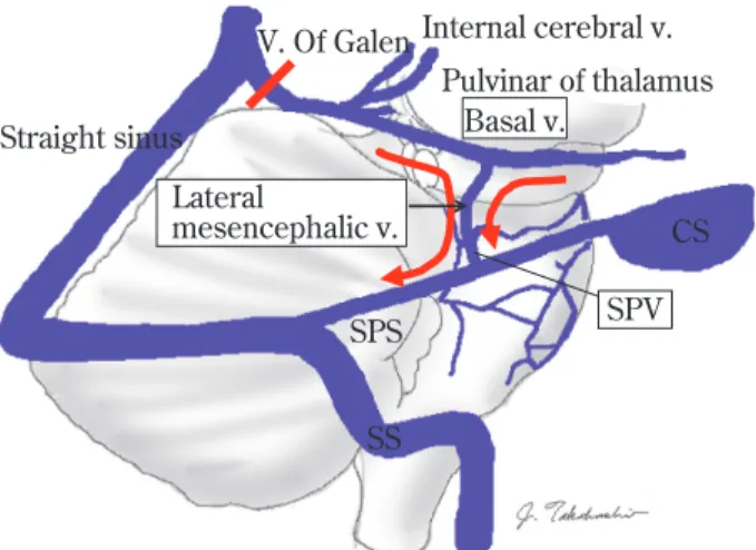Fig.   7  Veins of the cerebellar hemisphere and  the brain stem which constitute the  superior petrosal vein （SPV）complex