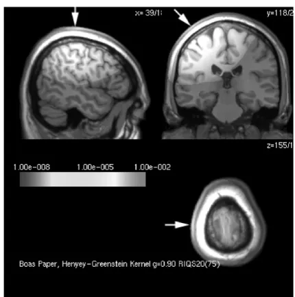 図 7: もちいた MRI と計算結果