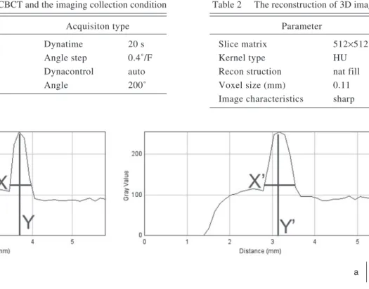 Fig. 6  The plot proﬁle curve. (a)  The pre-CBCT image (b)  The 3D-fusion image