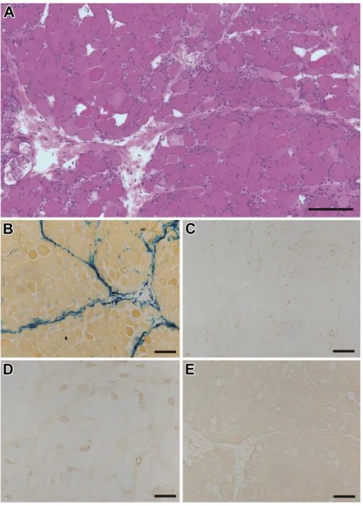 Fig. 2 Muscle pathology of the right biceps brachii muscle.