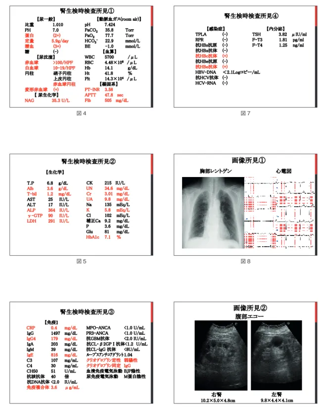 図 9 画像所見②腹部エコー右腎10.2×5.0×4.8cm 左腎 9.8×4.4×4.1cm図 8画像所見①胸部レントゲン心電図図 7【内分泌】TSH 3.82   μIU/mlF-T3            1.81    pg/mlF-T4           1.25    ng/ml【感染症】TPLA(-)RPR(-)抗HBs抗原(-)抗HBｓ抗体(-)抗HBc抗体(+)抗HBe抗原(-)抗HBe抗体(+)HBV-DNA＜2.1Logコピー/mL抗HCV抗体 (-)HCV-RNA(-)腎生検時検査