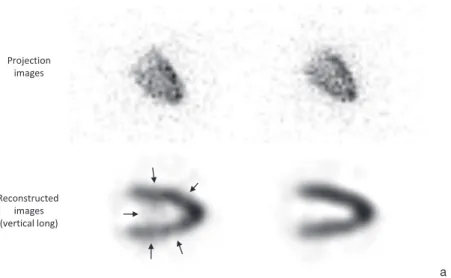 Fig. 1 Image examples of the myocardial phantom.