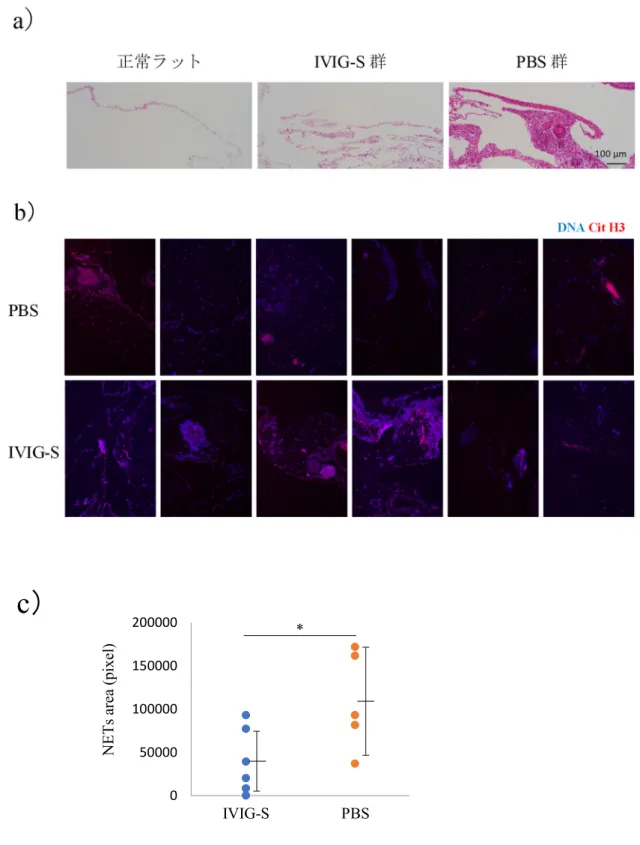 図 4. IVIG-S による MPO-AAV ラットモデル腹膜組織における NETs 形成の阻害 