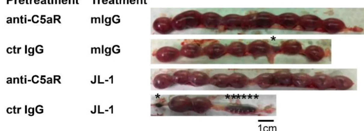 Figure 16 （A）. anti-C5aR または ctrIgG の前投与を行った JL-1 群および mIgG 群の各群における摘出した子宮の肉眼像 