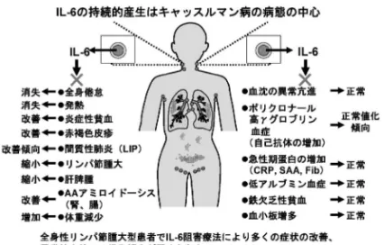 Fig. 2. IL-6 produced in aŠected lymph nodes induces the most of symptoms and abnormal ˆndings in plasma all type of Castleman disease, and those abnormalities are improved and normalized by the treatment with MRA, suggesting that the pathogenesis of this 