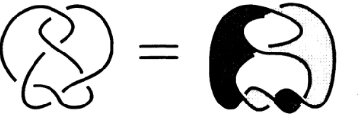FIGURE 11. A free Seifert surface $S$ of the $5_{2}$ knot