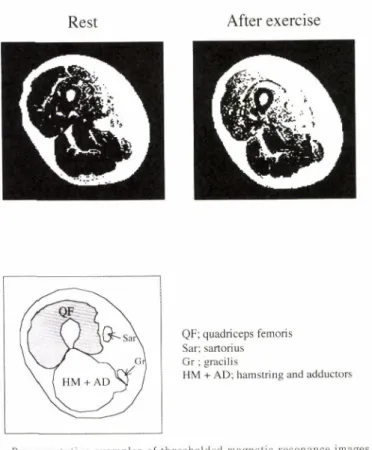 Figure  2.  Representative  examples  of  thresholded  magnetic  resonance  images  from  one 