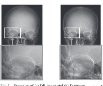 Fig. 3 Examples of (a) DR image and (b) D-raysum