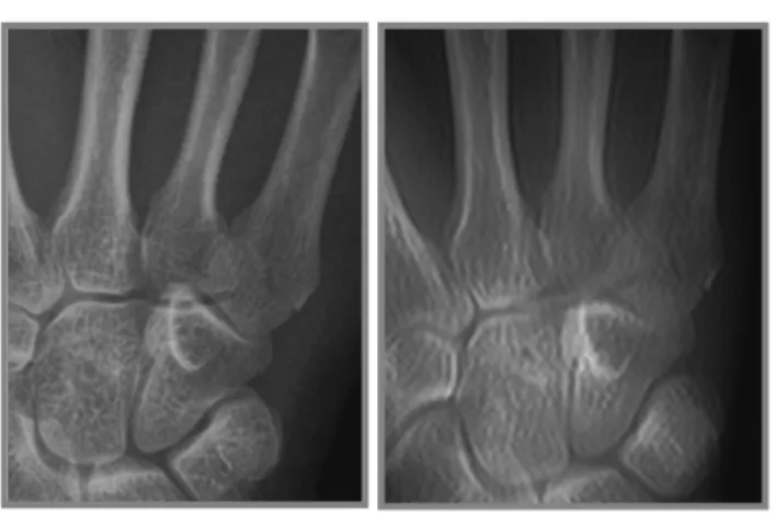 Fig. 8 Examples of (a) DR image and (b) D-raysum