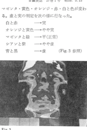 Figure  of  Colour  Thermography  on  Face