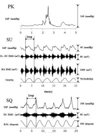 Fig. 7  A  typical  example  of  changes  in  IAP  and  EMG  during  PK,  SU,and  SQ.  PK:  placekick