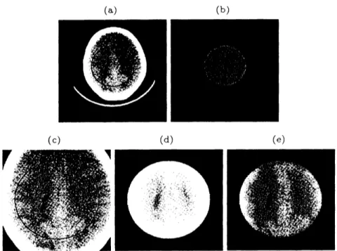 Figure 10: Head CT data. (a) Reconstructed image from full scan data using OS-EM and the interior ROI, (b) reference image for R-MAP method, (c) is magnification of (a), reconstructed ROI by using (c) OS-EM method and (d) R-MAP method