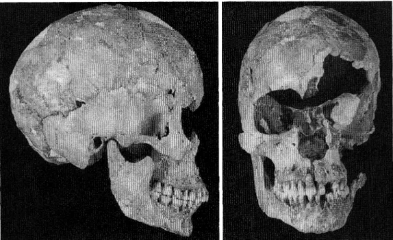 Fig.  2.  Right  lateral  and  facial  views  of  the  Shimodanosawa  skull.