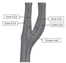 Fig. 6  Scheme of wall segmentations (inner wall of the external  carotid artery: inner ECA, outer wall of the external  carotid artery: outer ECA, inner wall of the ICA: inner  ICA, outer wall of the ICA: outer ICA, and divider wall)  for the carotid bifu
