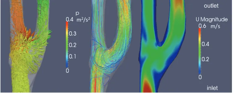 Fig. 11  Pressure vector (a), velocity stream line (b), and velocity distribution (c) predicted by CFD for the carotid bifur- bifur-cation model.