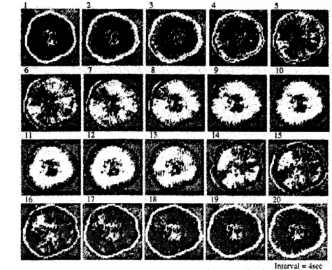 Fig. 2: 円形の変形体の厚さの上から撮った写真です。 時間ごとに番号を付けました。 画像は赤外 線の透過光ですので、 白い部分は薄く、 黒い部分は厚くなっています。 また、 この変形体の直径は $4\mathrm{c}\mathrm{m}$ 程度です。 弱結合位相反転が観察できますが、 その後、 この位相反転は消失し、 同位相になっているとこが観 察できます。 また、 周辺部位相反転は常に観察されています。 3