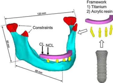 Fig. 2 – Distribution of Young ’ s modulus in the peri-implant bone. The height, width, and thickness of the buccal, lingual, crestal and inferior cortical bone of the mandible (mm) were measured.