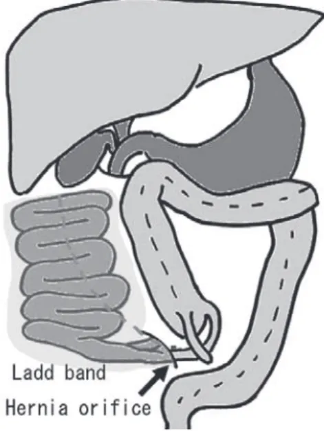 Fig. 6　Abdominal schema.
