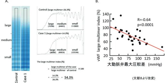 図 2 重症大動脈弁狭窄症症例における VWF large multimer index（文献 8 より改変）