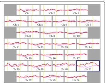 Fig. 3  Grand average waveforms showing changes in 