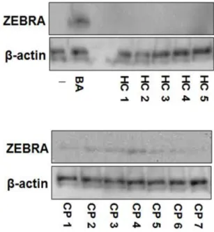 Figure  3. Saliva of CP patients induced  ZEBRA  expression. 