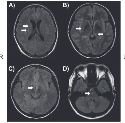 Fig. 2 MRI findings.