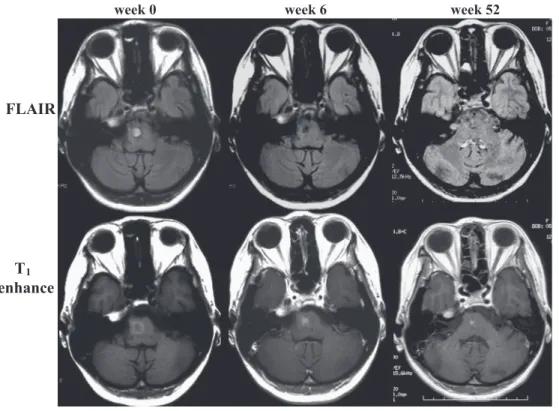 Fig. 2 IFX が著効した NBD の 1 症例（文献 14 より改変）．