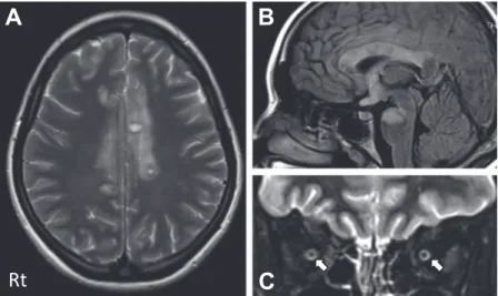 Fig. 3 MRI and contrast CT at 16 and 22 days after admission.