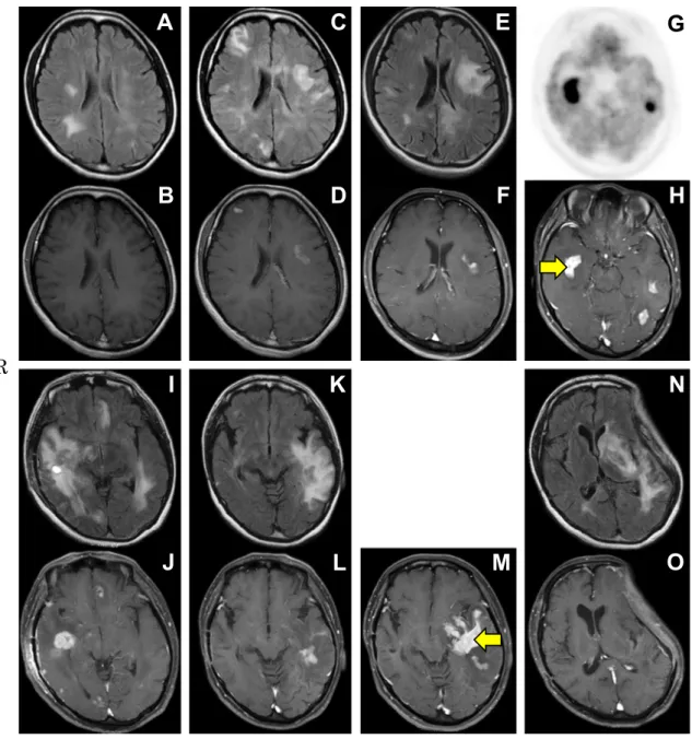 Fig. 1 Brain MRI and FDG-PET images.