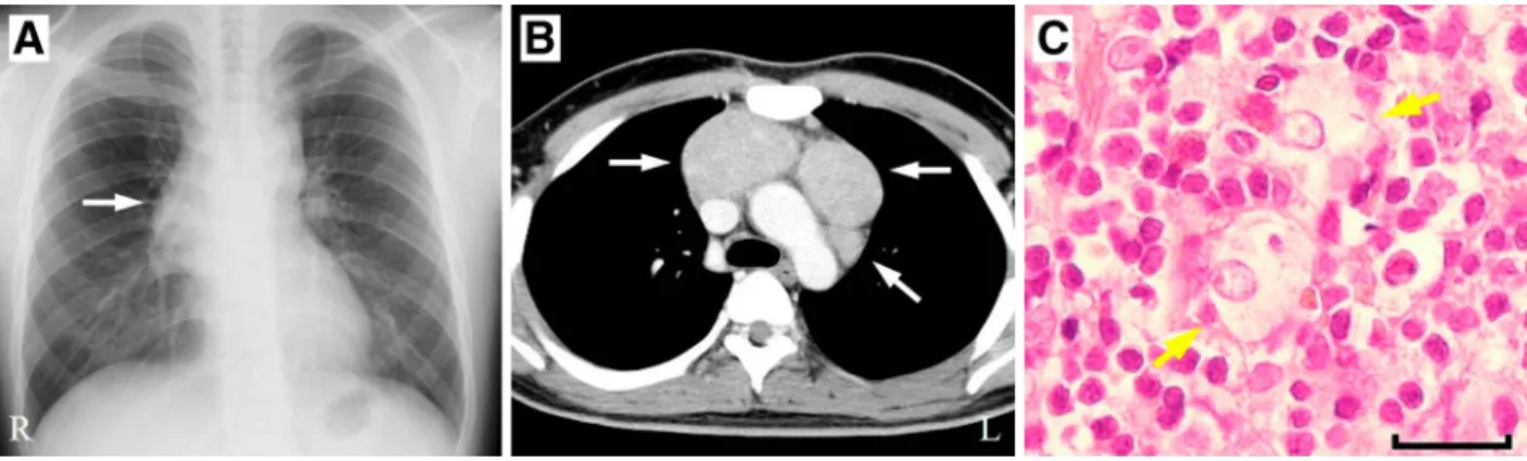 Fig. 1 Chest imaging and pathological findings.