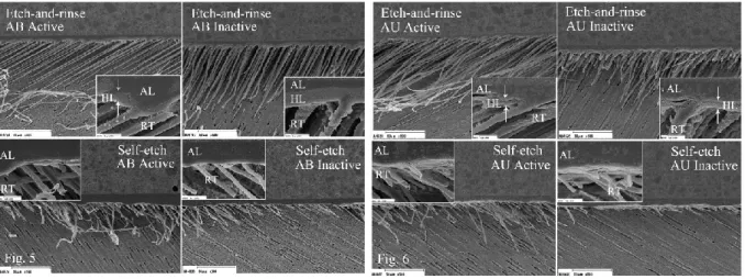 Fig. 4: Representative SEM images of treated dentin surfaces (AU). 