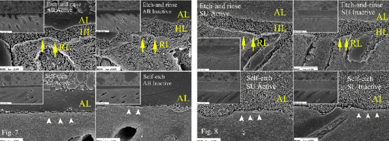 Fig. 7: Representative SEM images of the resin-dentin interfaces after argon-ion etching