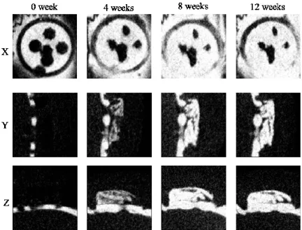Fig 4. Micro-CT images of the plastic cap in the 0.03% PDGF (ACS) group. 