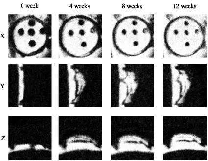 Fig 10. Micro-CT images of the plastic cap in the 0.03% PDGF (chitosan sponge) group. 