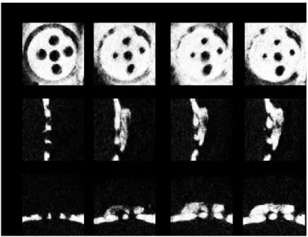 Fig 11. Micro-CT images of the plastic cap in the control (chitosan sponge) group. 