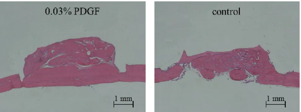 Fig 13. Representative histological results in the PDGF (chitosan sponge) at 12 weeks
