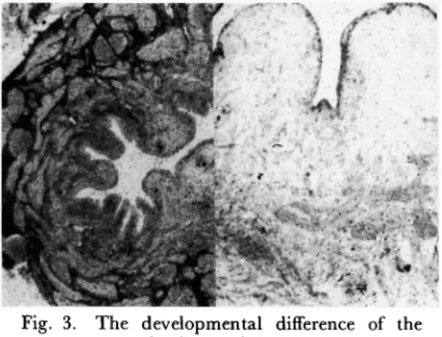 Fig.  3.  The  developmental  difference  of  the         muscular  layer  of  the  ureter  is marked 