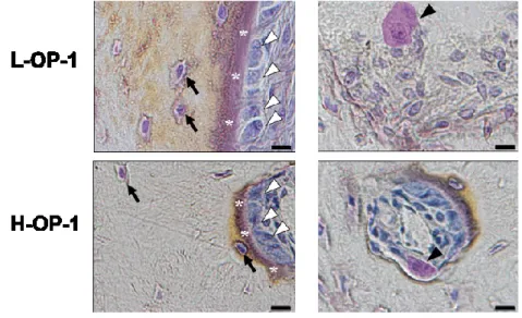 Fig. 10. BCM/OP-1 accelerated the differentiation of osteoblasts and osteoclasts at 8 weeks 