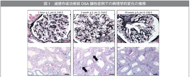 図 1 減感作成功術前 DSA 陽性症例での病理学的変化の推移