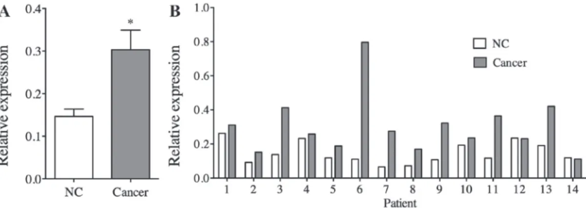 Figure 1. TRIM32 mRNA expression levels in gastric cancer tissues, as detected by reverse transcription‑quantitative polymerase chain reaction