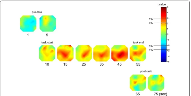 Fig. 3  Topographic presentation of the t value of the oxyhemoglobin (oxy-Hb) comparison between the control group and the autism spectrum  disorder (ASD) group during the Stroop color-word task