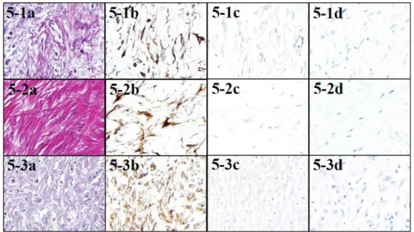Fig. 5 EvG and immunohistochemical staining of cases in EF- group 