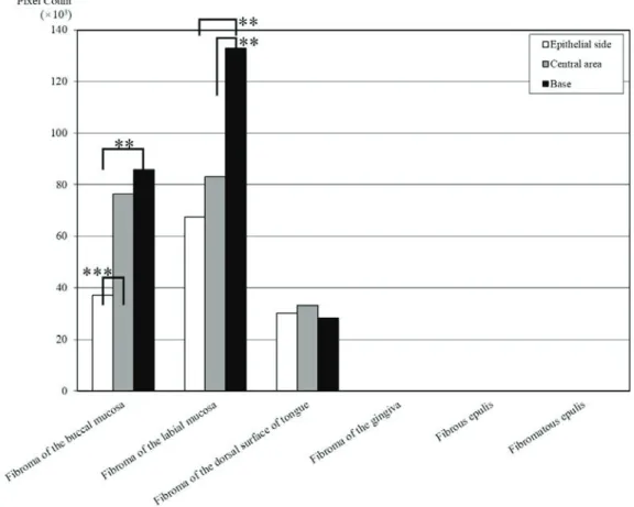Fig. 8 Comparison of quantity of elastic fibers among 3 areas in the same case 