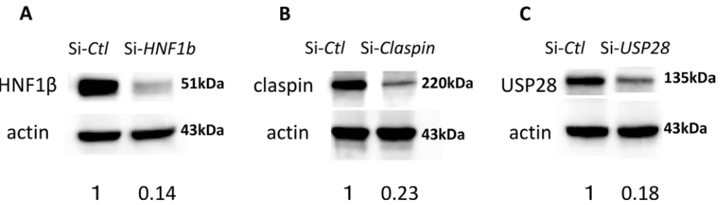 Figure 1:  Knock down efficiency of HNF-1β (A), Claspin (B), and USP28 (C) siRNA. Western blot analysis assays revealed that the  protein expression levels of HNF-1β (A), Claspin (B), and USP28 (C) were significantly decreased in the TOV21G si-HNF-1β, si-C